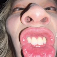 vaxl